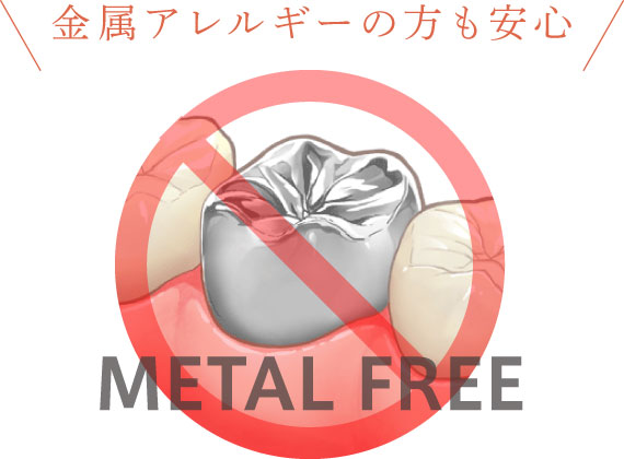 金属アレルギーの方も安心