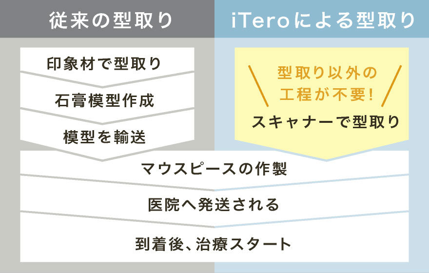 iTeroによる型取りは型取り以外の工程が不要!スキャナーで型取り