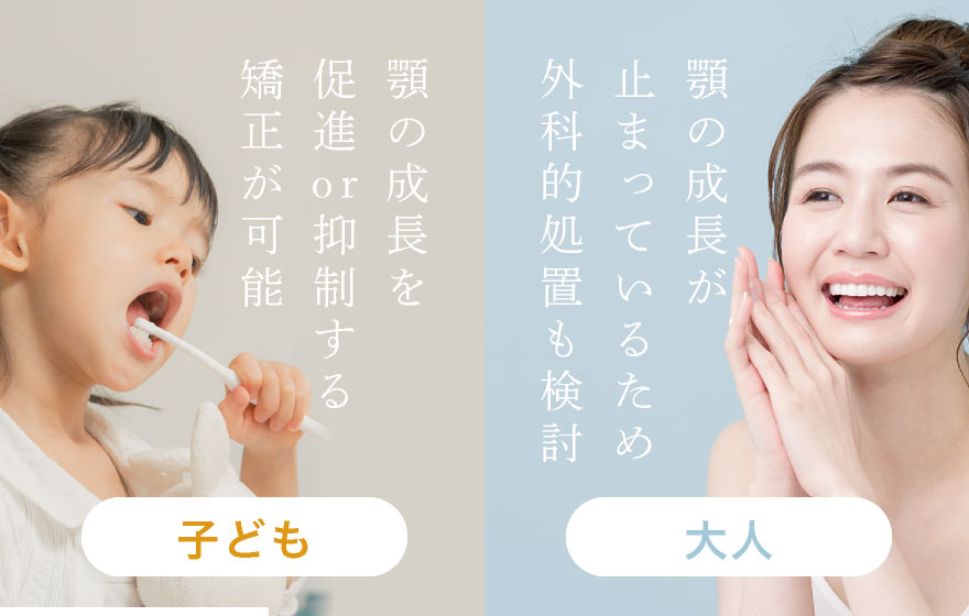 子ども:顎の成長を促進or抑制する矯正が可能 大人:顎の成長が止まっているため外科的処置も検討