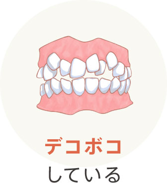 デコボコしている