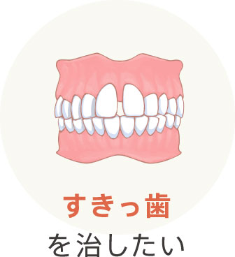 すきっ歯を治したい
